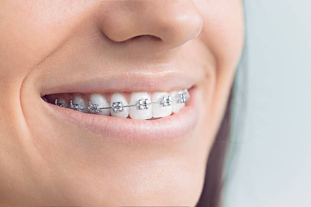 Best Invisalign and Clear Aligners  in Iuka, MS